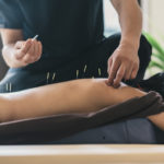 Physiotherapist Giving Accupuncture Treatment To Young Woman